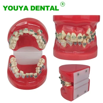 Стоматологичен ортодонтическая модел на зъби С метални и керамични брекетами Демонстрация на стоматологично лечение Модел Typodont за проучване при зъболекар